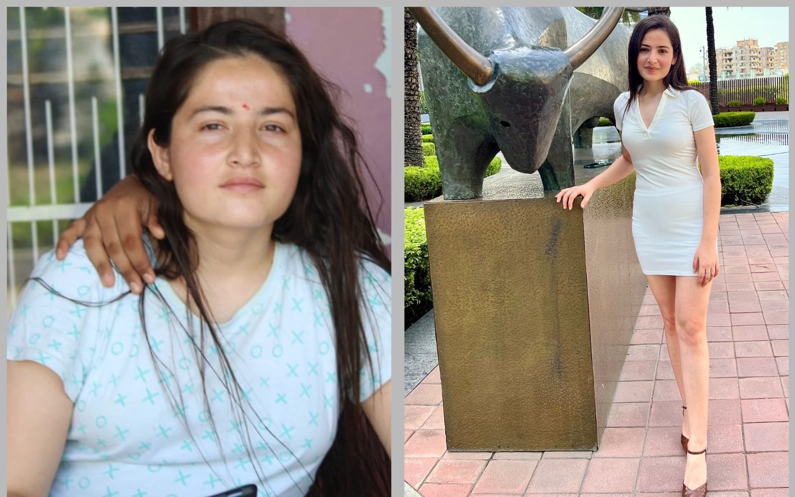 Weight loss before and after — Shivani Charak, cabin crew, Dubai, a client of Dr. Maruti Sharma